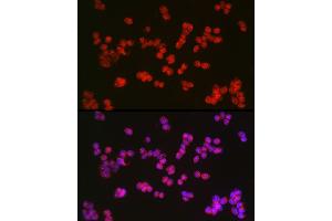 Immunofluorescence analysis of F9 cells using TET2 Rabbit pAb (ABIN6133019, ABIN6149017, ABIN6149019 and ABIN6221336) at dilution of 1:100 (40x lens).