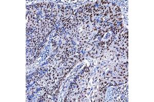 IHC analysis of SF3A1 using anti-SF3A1 antibody (ABIN7600556). (SF3A1 anticorps  (AA 20-556))