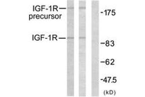Western blot analysis of extracts from 293 cells, treated with Insulin, using IGF1R (Ab-1161) Antibody. (IGF1R anticorps  (AA 1126-1175))