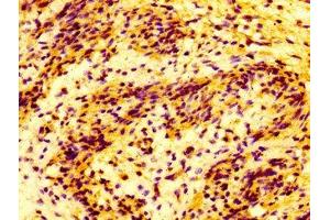 IHC image of ABIN7159070 diluted at 1:100 and staining in paraffin-embedded human lung tissue performed on a Leica BondTM system.