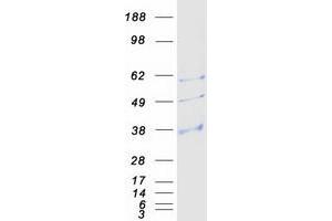 Validation with Western Blot