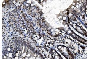IHC analysis of REA/PHB2 using anti-REA/PHB2 antibody (ABIN7599239). (Prohibitin 2 anticorps  (AA 1-299))