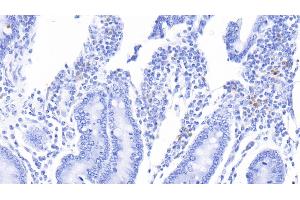 Detection of S100A12 in Bovine Colon Tissue using Polyclonal Antibody to S100 Calcium Binding Protein A12 (S100A12) (S100A12 anticorps  (AA 2-92))