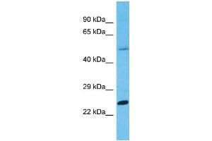 Western Blotting (WB) image for anti-Protease, serine, 45 (PRSS45) (C-Term) antibody (ABIN2791882) (PRSS45 anticorps  (C-Term))