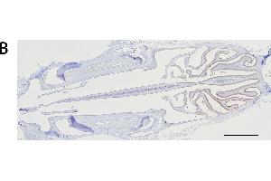 Immunohistochemistry analysis of the expression of the mu and alpha class GSTs.