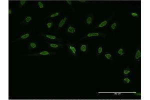 Immunofluorescence of monoclonal antibody to ZIC4 on HeLa cell.