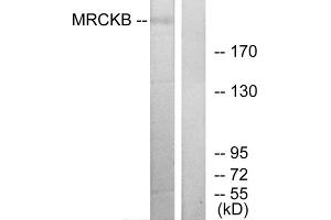 Western blot analysis of extracts from COLO cells, using MRCKB antibody. (CDC42BPB anticorps  (C-Term))