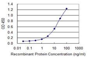 anti-Opa Interacting Protein 5 (OIP5) (AA 1-229) antibody