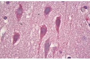 Anti-GRM8 / MGLUR8 antibody IHC staining of human brain, cortex neurons.