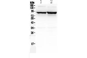Western blot analysis of SLC6A1 using anti-SLC6A1 antibody . (SLC6A1 anticorps  (N-Term))