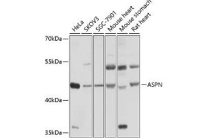 Western blot analysis of extracts of various cell lines, using ASPN antibody (ABIN6127375, ABIN6137217, ABIN6137218 and ABIN6214518) at 1:1000 dilution. (Asporin anticorps  (AA 100-379))