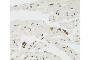 Immunohistochemistry of paraffin-embedded Rat heart using THAP1 Polyclonal Antibody at dilution of 1:100 (40x lens). (THAP1 anticorps)