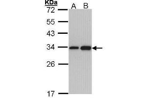 WB Image Sample (30 ug of whole cell lysate) A: Hep G2 , B: Molt-4 , 12% SDS PAGE antibody diluted at 1:1000 (RPL8 anticorps)