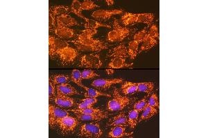 Immunofluorescence analysis of C6 cells using  Rabbit pAb (ABIN7265423) at dilution of 1:100 (40x lens).