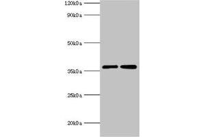 Western blot All lanes: MDH2 antibody at 3 μg/mL Lane 1: 293T whole cell lysate Lane 2: K562 whole cell lysate Secondary Goat polyclonal to rabbit IgG at 1/10000 dilution Predicted band size: 36, 31 kDa Observed band size: 36 kDa (MDH2 anticorps  (AA 59-338))