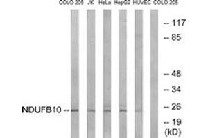 Western Blotting (WB) image for anti-NADH Dehydrogenase (Ubiquinone) 1 beta Subcomplex, 10, 22kDa (NDUFB10) (AA 63-112) antibody (ABIN2890436) (NDUFB10 anticorps  (AA 63-112))