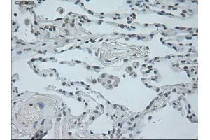 Immunohistochemical staining of paraffin-embedded lung tissue using anti-OSMmouse monoclonal antibody. (Oncostatin M anticorps  (AA 25-252))