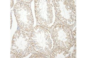 Immunohistochemistry (IHC) image for anti-Heterogeneous Nuclear Ribonucleoprotein U-Like 1 (HNRNPUL1) (AA 50-100) antibody (ABIN7448953) (HNRNPUL1 anticorps  (AA 50-100))