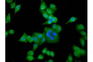 Immunofluorescence staining of Hela cells with ABIN7143823 at 1:133, counter-stained with DAPI. (ACTN3 anticorps  (AA 497-667))