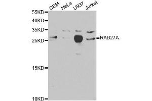 Western Blotting (WB) image for anti-RAB27A, Member RAS Oncogene Family (RAB27A) antibody (ABIN1874505) (RAB27A anticorps)