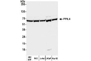 Western Blotting (WB) image for anti-Peptidylprolyl Isomerase (Cyclophilin)-Like 4 (PPIL4) (AA 375-425) antibody (ABIN7450591) (PPIL4 anticorps  (AA 375-425))