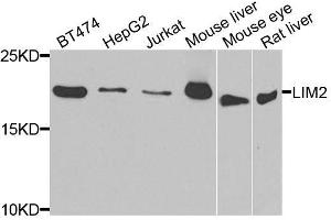 Western blot analysis of extracts of various cell lines, using LIM2 antibody. (LIM2 anticorps  (AA 25-110))