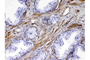 IHC analysis of VEGF Receptor 3 using anti-VEGF Receptor 3 antibody .