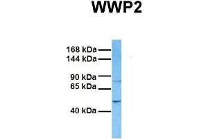 Host:  Rabbit  Target Name:  WWP2  Sample Tissue:  Human Fetal Liver  Antibody Dilution:  1. (WWP2 anticorps  (Middle Region))