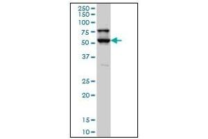 Western Blotting (WB) image for anti-serine/threonine Kinase 17a (STK17A) (AA 301-414) antibody (ABIN614691) (STK17A anticorps  (AA 301-414))