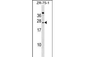 IGSF6 Antibody (Center) (ABIN1538572 and ABIN2849263) western blot analysis in ZR-75-1 cell line lysates (35 μg/lane). (IGSF6 anticorps  (AA 69-97))