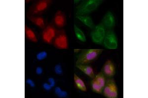 ABIN7093813 and ABIN7097856 staining  cells by IF/ICC. (PRAME anticorps  (C-Term))