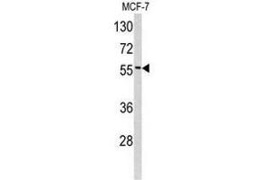 Image no. 1 for anti-Epsin 3 (EPN3) (N-Term) antibody (ABIN452971)