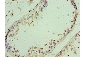 Immunohistochemistry of paraffin-embedded human testis tissue using ABIN7143999 at dilution of 1:100