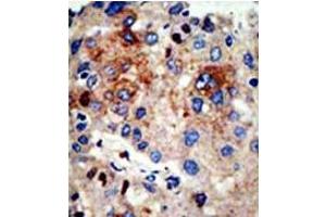 Image no. 3 for anti-Histone Deacetylase 9 (HDAC9) (N-Term) antibody (ABIN356655)