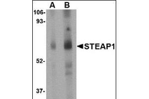 Western blot analysis of STEAP1 in human spleen tissue lysate with this product at (A) 1 and (B) 2 μg/ml. (STEAP1 anticorps  (Center))