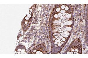 ABIN6272935 at 1/100 staining Mouse colon tissue by IHC-P. (AHCYL1 anticorps  (N-Term))