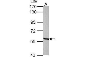 MCCC2 antibody  (Center)