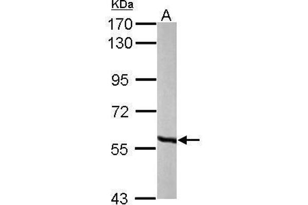 MCCC2 antibody  (Center)