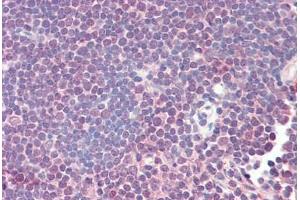 Human Thymus (formalin-fixed, paraffin-embedded) stained with ZAP70 antibody ABIN461961 at 20 ug/ml followed by biotinylated anti-mouse IgG secondary antibody ABIN481714, alkaline phosphatase-streptavidin and chromogen. (ZAP70 anticorps)