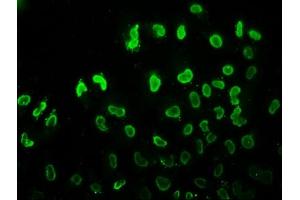 Immunofluorescence staining of Hela cells (treated with 30mM sodium butyrate for 4h) with ABIN7139180 at 1:7.
