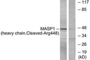 Western blot analysis of extracts from A549 cells, treated with etoposide 25uM 24h, using MASP1 (heavy chain,Cleaved-Arg448) Antibody. (MASP1 anticorps  (Cleaved-Arg448))