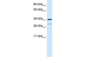 Western Blotting (WB) image for anti-Vacuolar Protein Sorting 72 Homolog (S. Cerevisiae) (VPS72) antibody (ABIN2460856) (VPS72 anticorps)