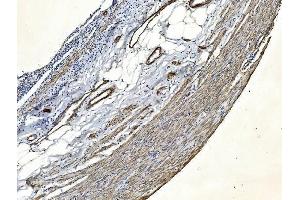 IHC analysis of Filamin A/FLNA using anti-Filamin A/FLNA antibody (ABIN7601783). (Filamin A anticorps  (AA 451-638))