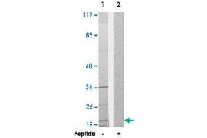 Western blot analysis of extracts from HepG2 cells, using TAF9 polyclonal antibody . (TAF9 anticorps)