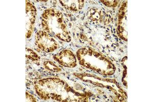 Immunohistochemistry of paraffin-embedded human kidney using SMAD9 antibody at dilution of 1:100 (x400 lens). (SMAD9 anticorps)