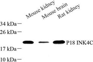 Western blot analysis of P18 INK4C (ABIN7073645) at dilution of 1: 500 (CDKN2C anticorps)