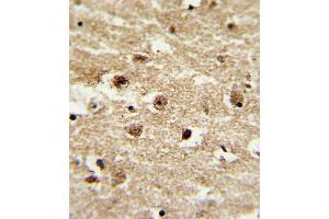 Formalin-fixed and paraffin-embedded human brain tissue with IGFBP2 Antibody (C-term), which was peroxidase-conjugated to the secondary antibody, followed by DAB staining.