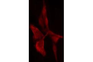 ABIN6274714 staining 293 cells by IF/ICC. (PSMD11 anticorps  (Internal Region))