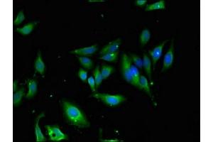 anti-Unc-13 Homolog D (UNC13D) (AA 7-172) antibody