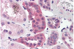 Human Kidney (formalin-fixed, paraffin-embedded) stained with RPAIN antibody ABIN214468 at 5 ug/ml followed by biotinylated goat anti-rabbit IgG secondary antibody ABIN481713, alkaline phosphatase-streptavidin and chromogen. (RPAIN anticorps  (C-Term))